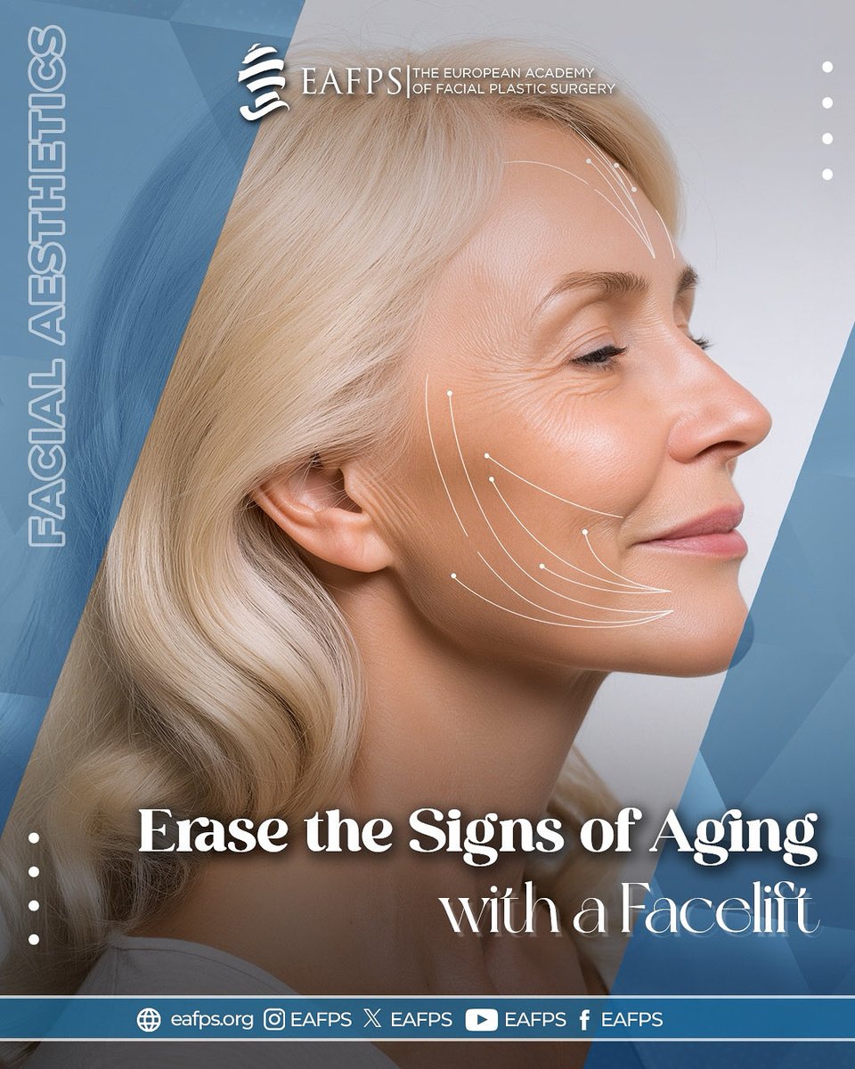Want to write a new story on your face one that reflects vitality, confidence, and youth while keeping your natural charm intact? ✨

A #facelift is not about changing who you are; it’s about helping you look as vibrant as you feel.