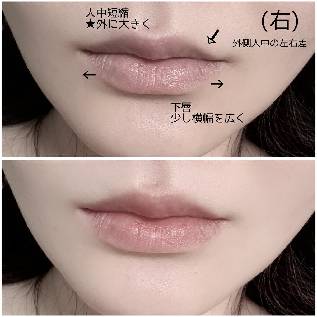 明日ヒアル受けることに！
伝えることまとめた💉

『絶対にクチバシ部分にはいれないで』も追加で😌

唇ヒアルの痛み苦手😭 https://t.co/m2GbLDqlUd