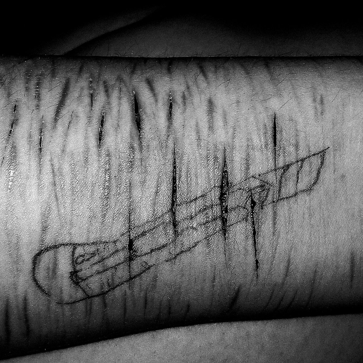 #selfharm