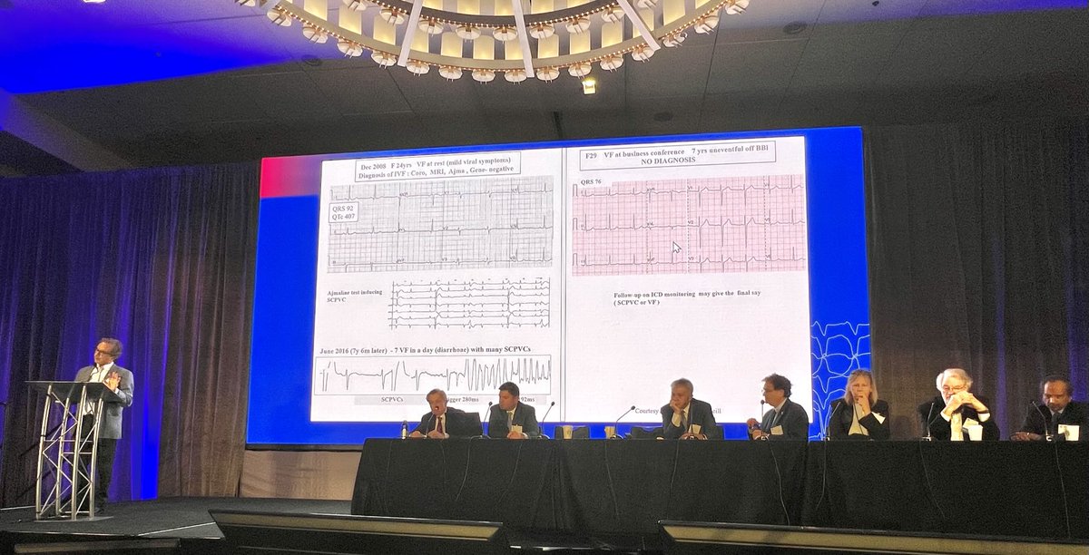 DrRoderickTung's tweet image. Legend Michel Haissaguerre leading off ventricular fibrillation session @VTSymposium. #ablateVF