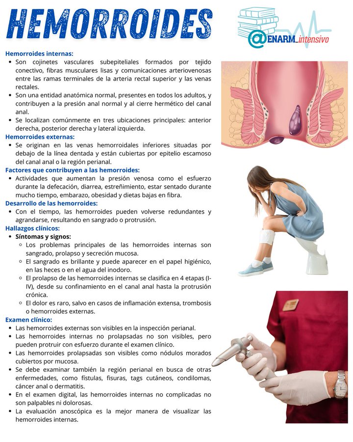ENARM_intensivo's tweet image. 🎴HEMORROIDES  

#ENARM_INTENSIVO #ENARMX #ENARM #ENARM2025 #ESTUDIA_MEDICINA #FACMED  

Saber  más👇
homomedicus.com/enfermedad-hem…