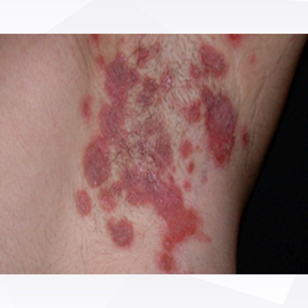 jbjs's tweet image. Do you know the correct answer?
To reveal it, head over to the new October Quiz of the Month: bit.ly/qotmoct2025