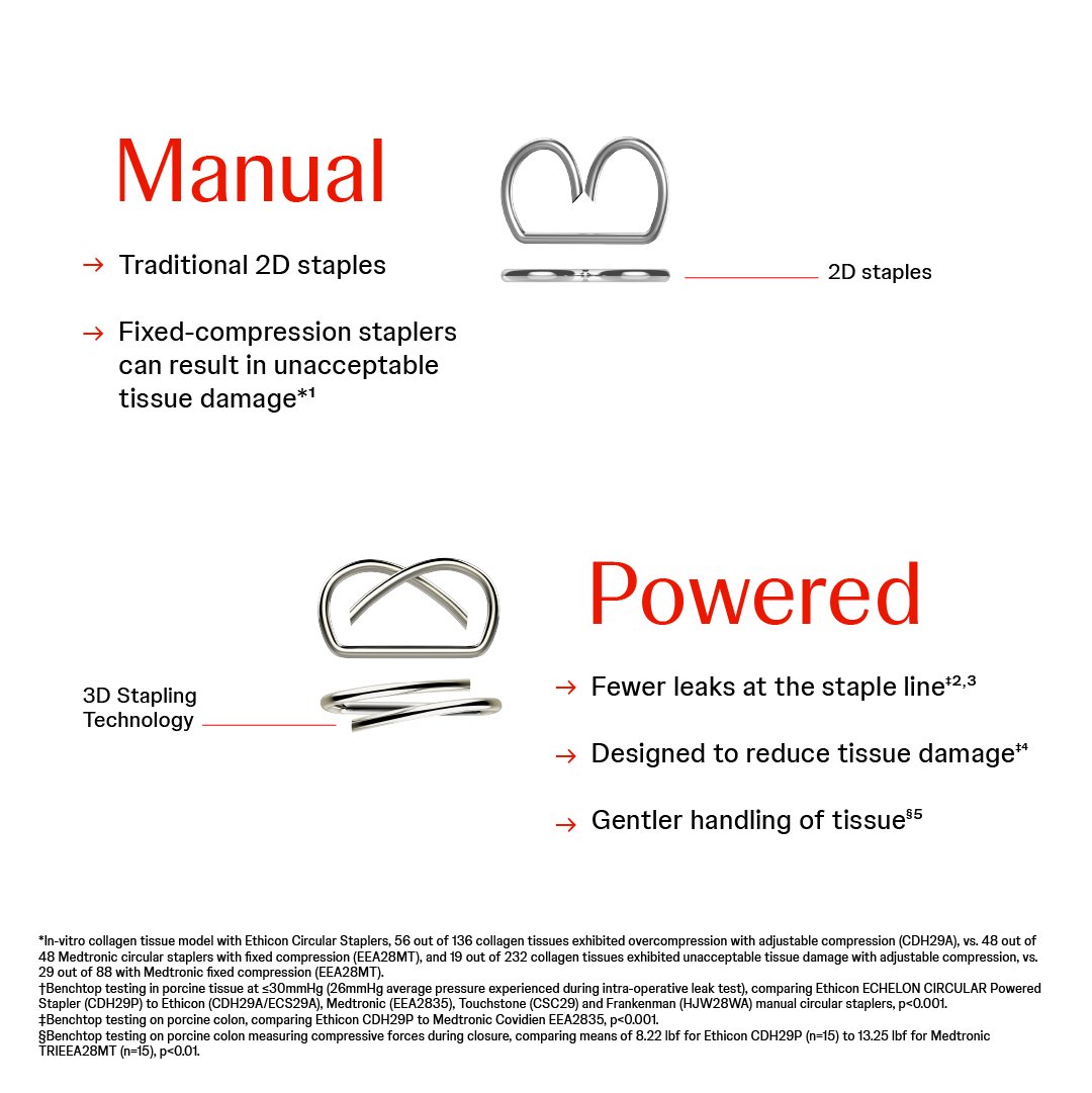 JNJMedTech's tweet image. When it comes to higher-risk colorectal surgery, more and more surgeons are reaching for a powered circular stapler.

Read the article: bit.ly/4icAumc

This content is intended for individuals within the United States. Products may not be available and/or approved or…