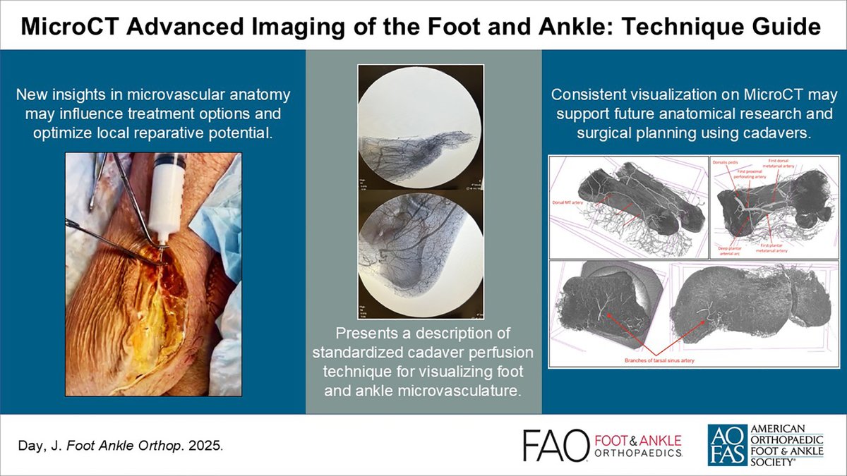 AOFAS_Journals's tweet photo. This technique guide describes how to perfuse cadaveric specimens in order to visualize microvascular anatomy using MicroCT advanced imaging. @DayOrtho 

Read in FAO: https://t.co/MOTA1yjoqk https://t.co/BYWniWB2V8