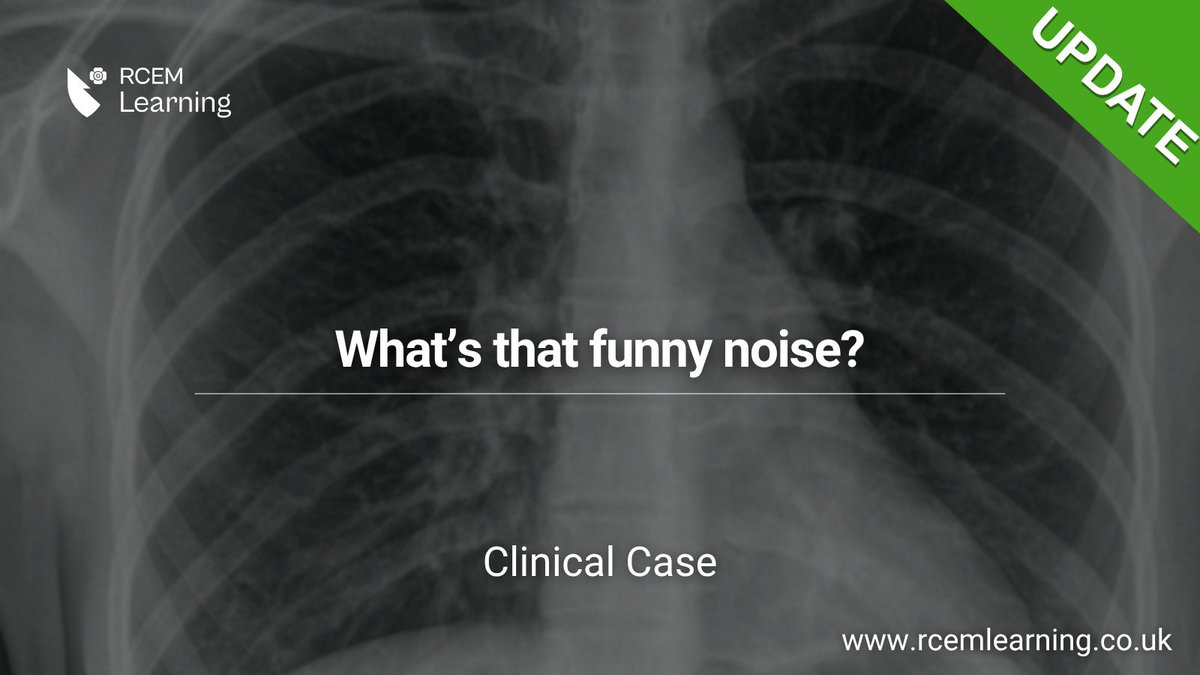 RCEMLearning's tweet image. UPDATE: A 17-year-old presents with acute respiratory distress and a biphasic stridor.
What is the most appropriate initial clinical assessment? #ClinicalCase
rcemlearning.co.uk/modules/whats-…
