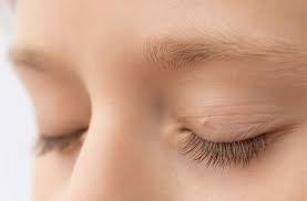 robertlufkinmd's tweet photo. Please don't ignore skin tags.

They are often a cutaneous marker 
for impaired carbohydrate metabolism
and metabolic dysfunction. 

“skin tags should be considered 
clinical markers of hyperinsulinemia.”

https://t.co/B20P6wkqYw. https://t.co/dMs2S0KVOi