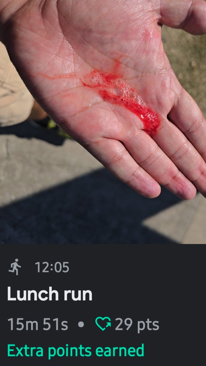 MesoHunter_YT's tweet image. Down to 8 min miles. Guess lungs didn&apos;t care for it..
Whole reason I got medically retired from the Army anyways.  Lungs got f**ked up in Iraq. 
Whatever pain is weakness leaving the body. 
Something POGS and all these soft chasers will never understand. #wxtwitter #Military