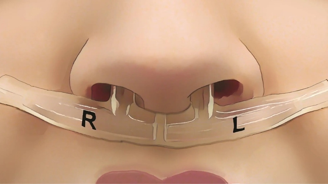 📊What if the way you breathe could reveal your state of mind or even your identity?

Researchers at <a href="/WeizmannScience/">Weizmann Institute</a> have discovered that each of us has a unique “breath print,” identifiable with nearly 97% accuracy.

<a href="/WMHDay/">WorldMentalHealthDay</a> #WorldMentalHealthDay #ScienceNews
