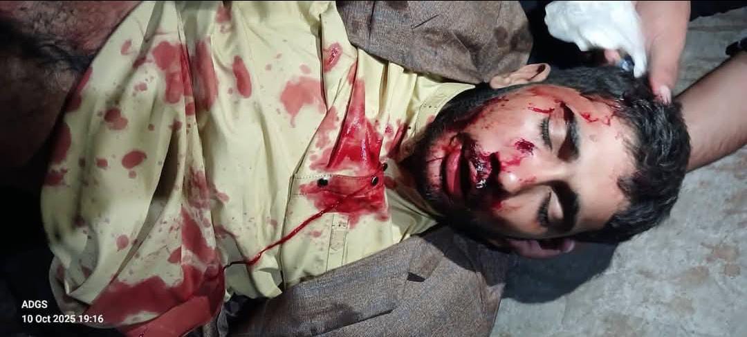 A state must embody restraint and pursue political reconciliation, not coercion. The suppression of TLP is unjust — I categorically condemn it. #HumanRightsorg #TLP #UNcouncil