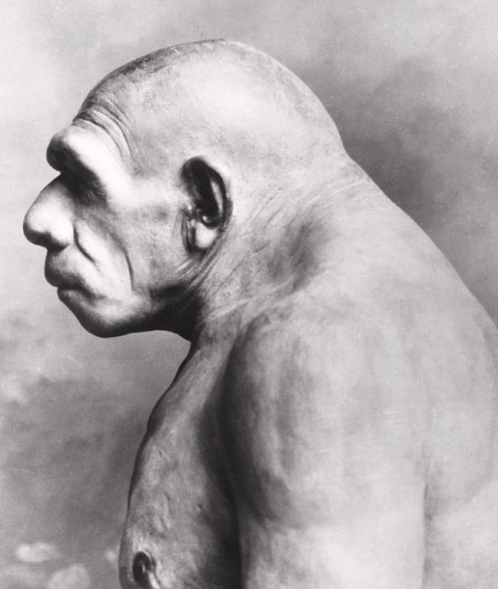 Neanderthal Man❗️❗️