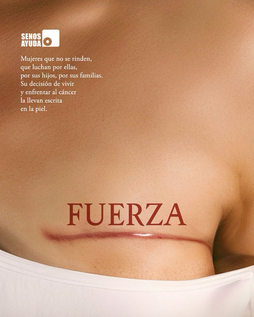 SenosAyuda A.C. tweet media