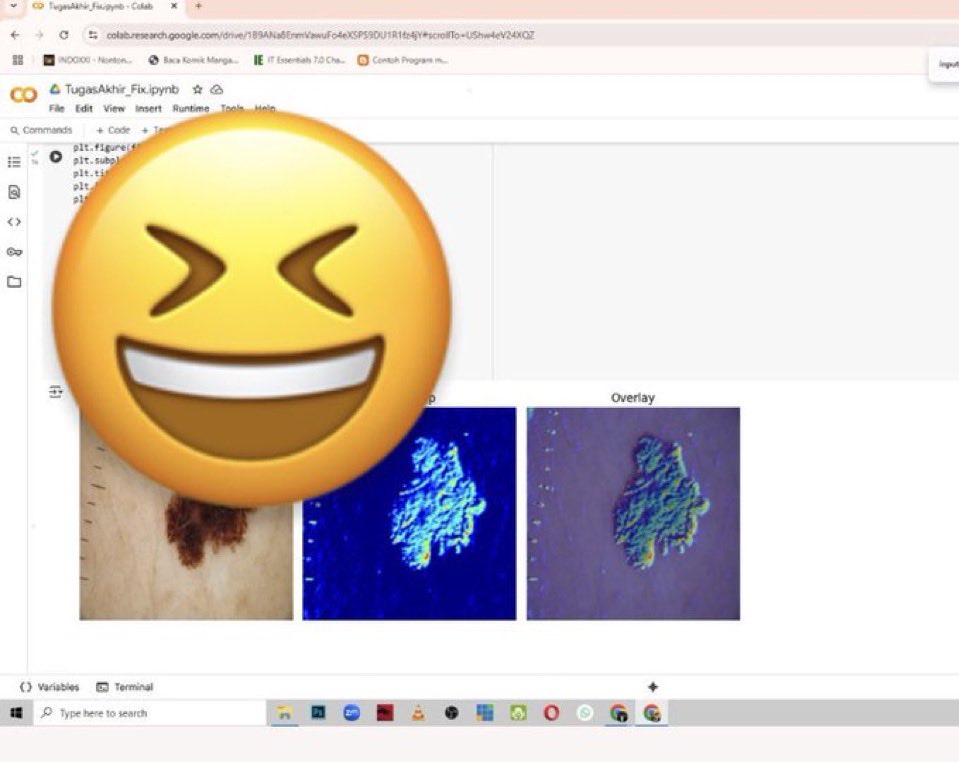 YUKJOKII1's tweet image. joki Deteksi Penyakit Kulit dengan deep learning pada Pythonn  !!, Buat kalian yang mau tugas nya selesaii bisa cek WA di bio yaawww!!! #jokitugas  #jokicoding #Jokiskripsi #zonaba #zonauang #zonajajan️️