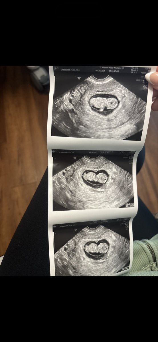 savz81's tweet photo. his upside down rubber duck era, his gummy bear era, starting to look like a baby to actually looking like a baby!!! my sweet boy 😭😭😭 https://t.co/I5v4ni3wBn