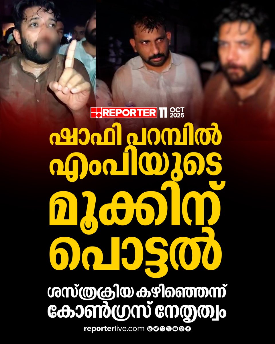 reporter_tv's tweet photo. ഇന്ന് മുതൽ സംസ്ഥാനത്ത് കോണ്ഗ്രസ് പ്രതിഷേധം സംഘടിപ്പിക്കും
Read Story : https://t.co/FuDfeBBgCT
Watch Live: https://t.co/GG5pGaGeJG
Download Reporter Live App: https://t.co/Iur9cSKcrd
#ShafiParambil #congresspoliceclash #shafiparambilattack #Congress #UDF #keralapolice #ReporterLive