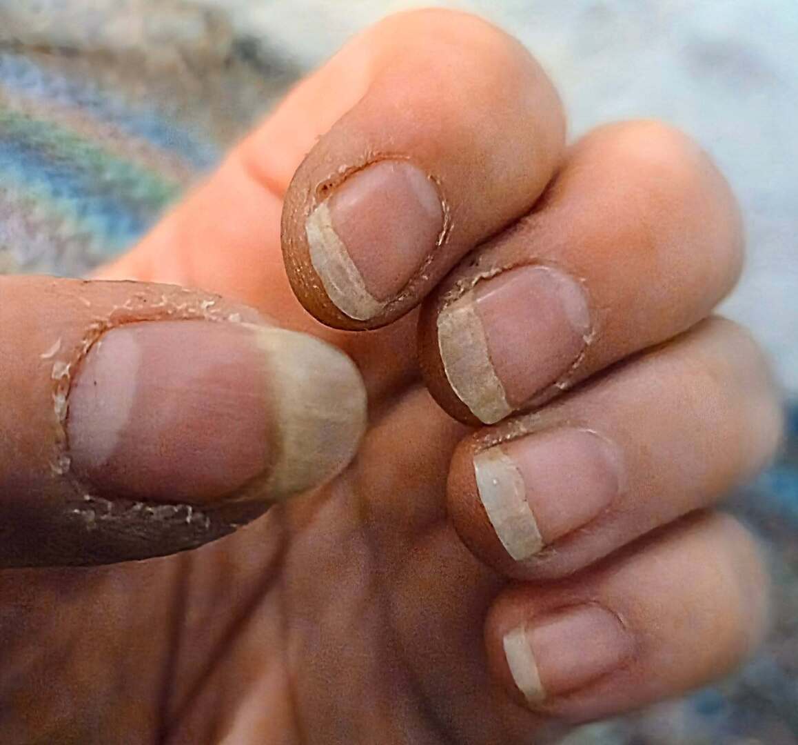 k8thnote's tweet image. I'm sad that it's become so difficult to do simple things. I'm trying with every part of me not to lose my joy. My hands even show signs that I'm not playing enough guitar or digging in the dirt enough; I have long, clean fingernails. My hair is knotted … instagr.am/p/DPpqyKTk07t/