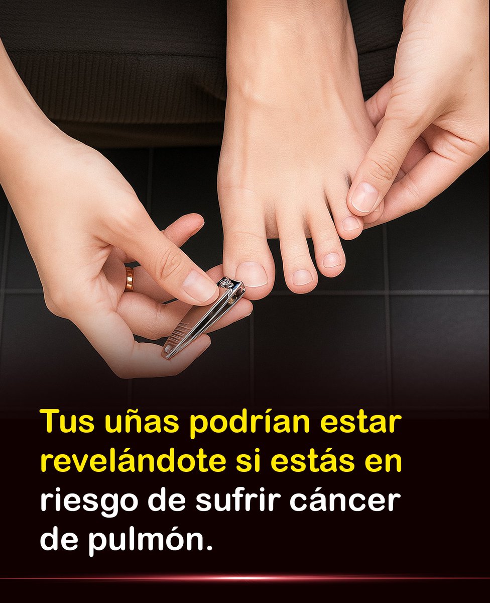 Bio_comunidad's tweet image. Tus uñas podrían estar mostrando una señal silenciosa sobre tu salud que casi nadie nota… y podría estar relacionada con el cáncer de pulmón. 👇

Mayor info: wp.me/p9eYmY-9bZ