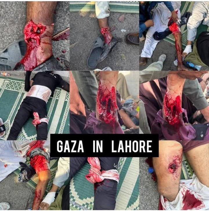 BasitKhokhar15's tweet photo. #گولی_کیوں_چلارہےہو https://t.co/c4CykaB1WA