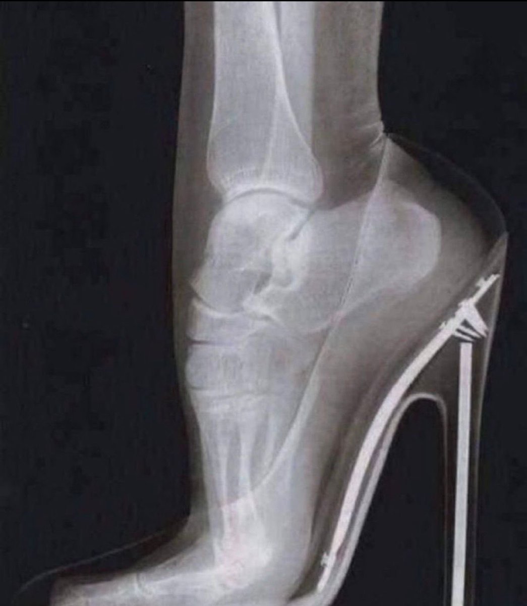 Uniquemaniaz's tweet image. Men don’t understand the pain we go through just to look beautiful for them