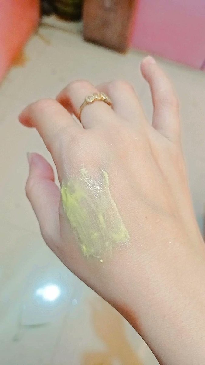 Kena percikan minyak ,langsung gercep dipakein sabun colek biar g gelembung nih kulit 🤭🤣