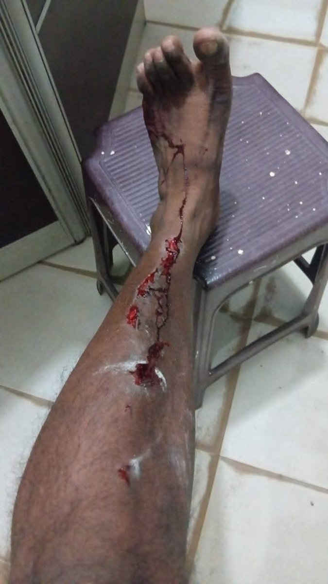 TamilGuardian's tweet image. 🚨 LEAD - Sri Lankan police unleash brutal assault on Tamils in Mannar

Sri Lankan police launched a violent assault on peaceful protesters in Mannar on Friday night, leaving priests, women and men hospitalised, in a fresh escalation of tensions over the controversial wind power…