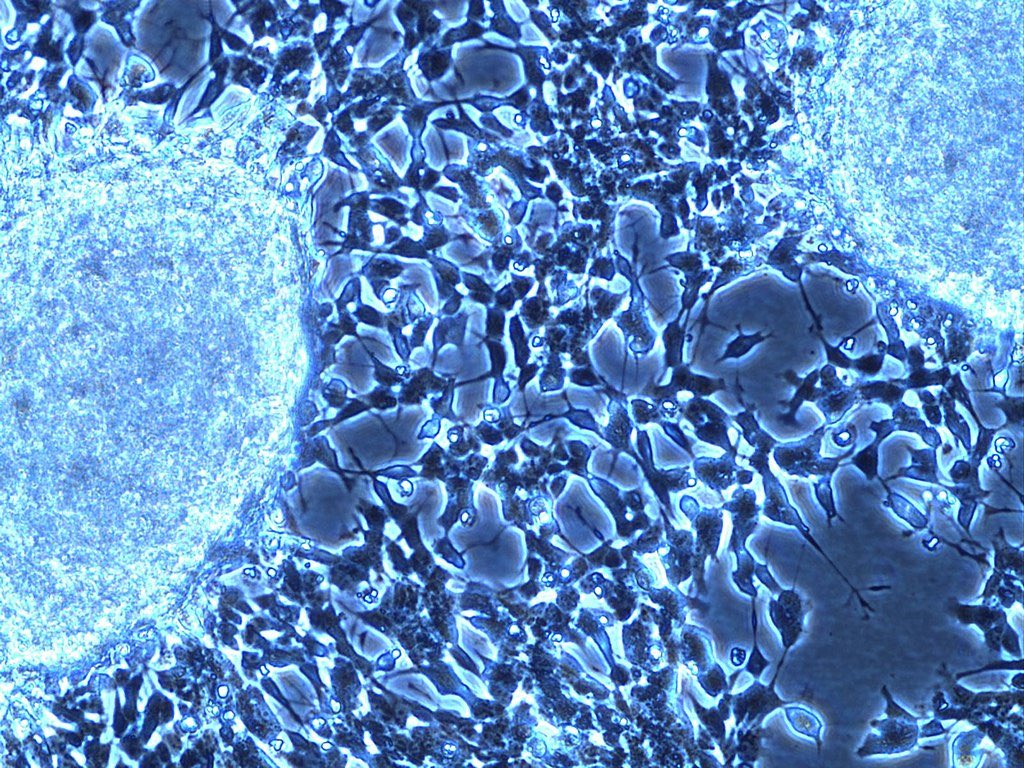 accegen's tweet photo. 🔬 
SH-SY5Y is a versatile human neuroblastoma cell line, widely used in Alzheimer’s, Parkinson’s &amp; neurotoxicity research. 
A trusted model for neuronal differentiation &amp; drug discovery.

https://t.co/2K1y217dyl

#Neuroscience #CellBiology #DrugDiscovery https://t.co/uTFjQQXtBd