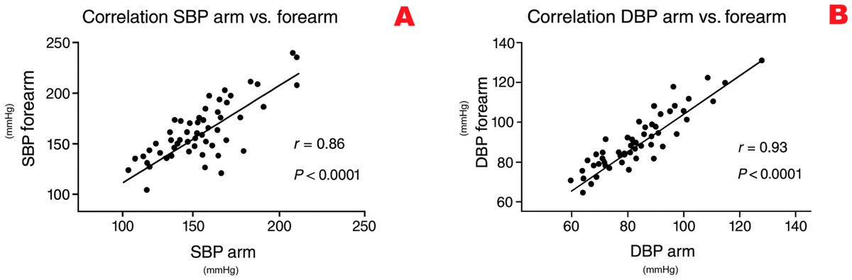Tatiana Palotta Minari et al. measured and compared blood pressure values from the arm and forearm using the oscillometric method, focusing on hypertensive patients with obesity and prediabetes.

Check it here: mdpi.com/2673-4540/6/9/…