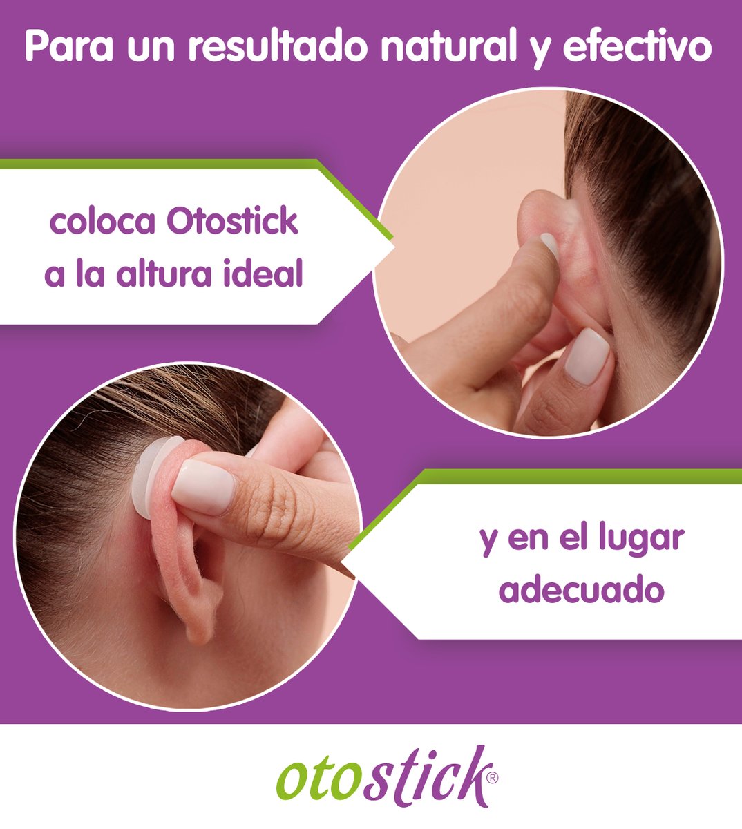 Coloca Otostick en el lugar correcto y a la altura ideal… ¡y consigue ese efecto estético y natural que tanto te gusta! 💫👂 😉

otostick.com
💜💜💜💜

#Otostick #orejas #cosmético #orejasdesoplillo #Otoconsejo #efectoOtostick #corrector #belleza #efectonatural