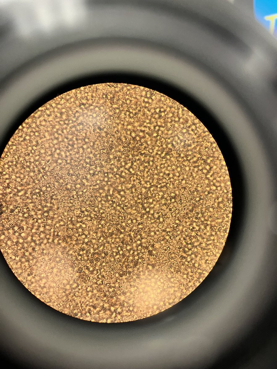 Urine rounds with the renal team 🫘 <a href="/HofstraKidney/">HofNorthwell Kidney</a> <a href="/NorthwellChiefs/">Northwell Internal Medicine Chief Residents</a>