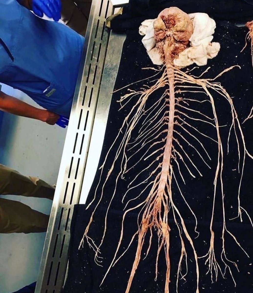 Smart1Doctor1's tweet image. This is what the human nervous system looks like.
.
.
.
.
#NervousSystem #HumanAnatomy #Neuroscience #BrainAndNerves #HealthEducation #MedicalScience #CentralNervousSystem #PeripheralNervousSystem #Neurons #Anatomy #BodySystems #Neurobiology #HealthAwareness #MedicalIllustration