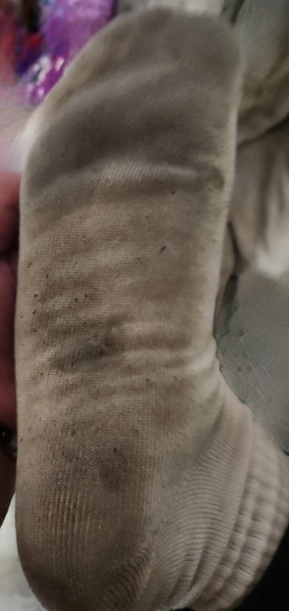 SIONsockssuki's tweet photo. 今回も10日ぐらい連履きしたけど、友達とテニスしたりして何回も遊んだからいつもより黒くなった気がする😂w

欲しい方いましたら、DMください☺️✨ https://t.co/kzR6RwS7rV