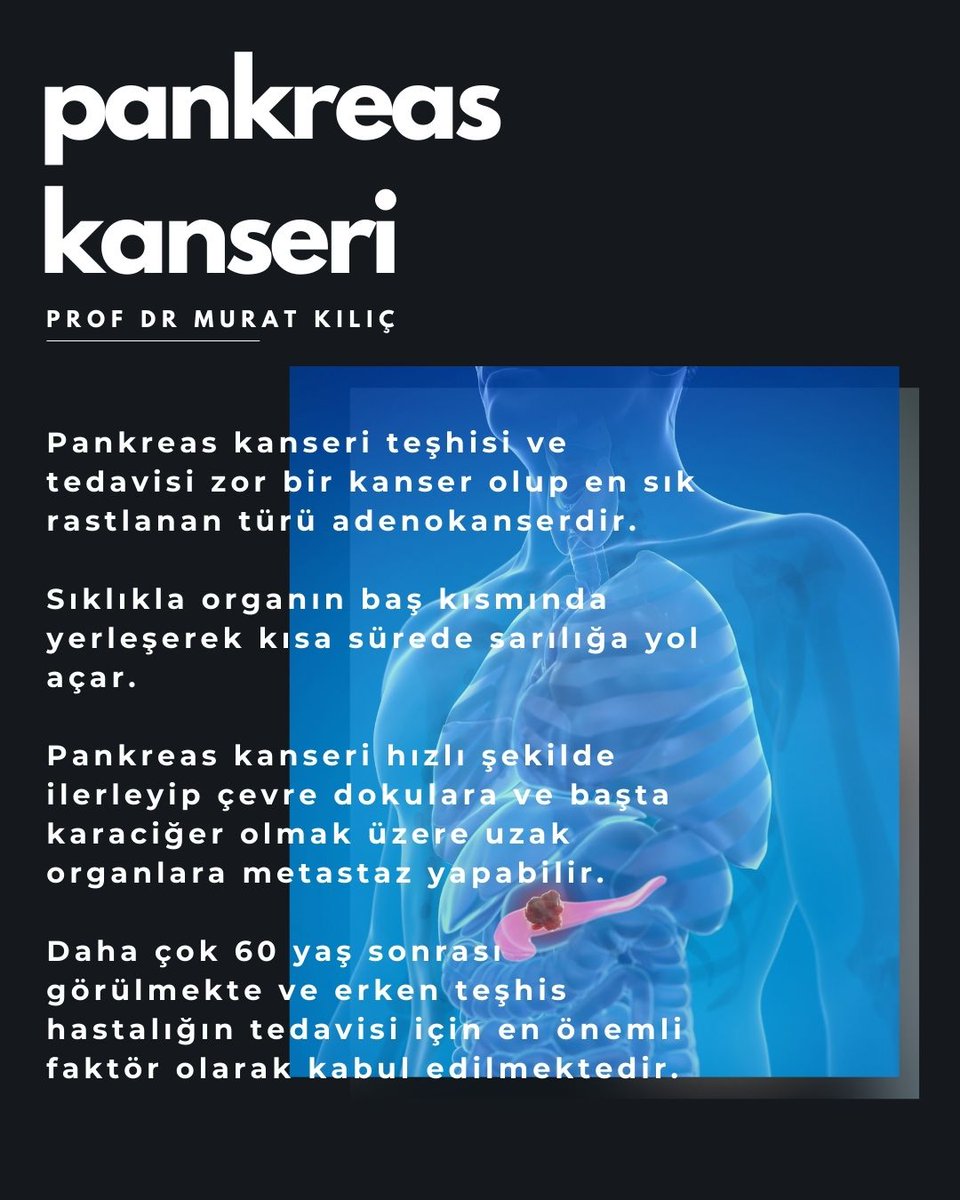 profdr_mkilic's tweet photo. https://t.co/RRt5VZg3nt

#pankreaskanseri
#pankreaskanseritedavisi https://t.co/3bRrhrMJPL