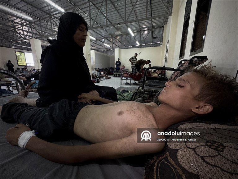 Abdallahallattr's tweet photo. The young Muhammad Riyad Atta Zenon (21 years) is lying in Nasser Medical Complex in Khanyunes, suffering from partial kidney failure and living with half a kidney, amid a life-threatening risk due to malnutrition and lack of treatment. As his sister Dima (14 years old) suffers https://t.co/xmRUpW0r7q