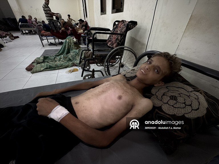 Abdallahallattr's tweet photo. from concussion and short in height, his brother Youssef faces repeated respiratory crises as a result of his asthma, in a scene that embodies the depth of the health tragedy that
the people of Gaza are experiencing under siege.
#freepalestine #stopbombinggaza #stopthestarvation https://t.co/6rK0kKL32N