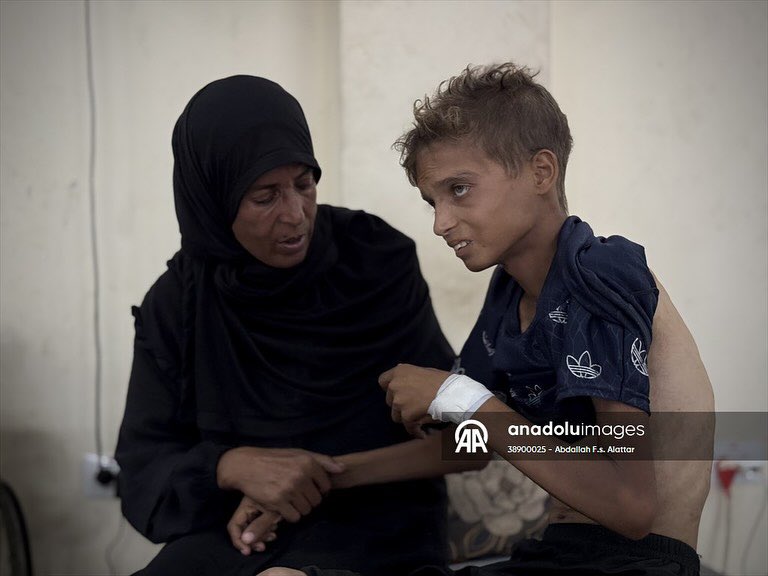 Abdallahallattr's tweet photo. from concussion and short in height, his brother Youssef faces repeated respiratory crises as a result of his asthma, in a scene that embodies the depth of the health tragedy that
the people of Gaza are experiencing under siege.
#freepalestine #stopbombinggaza #stopthestarvation https://t.co/6rK0kKL32N