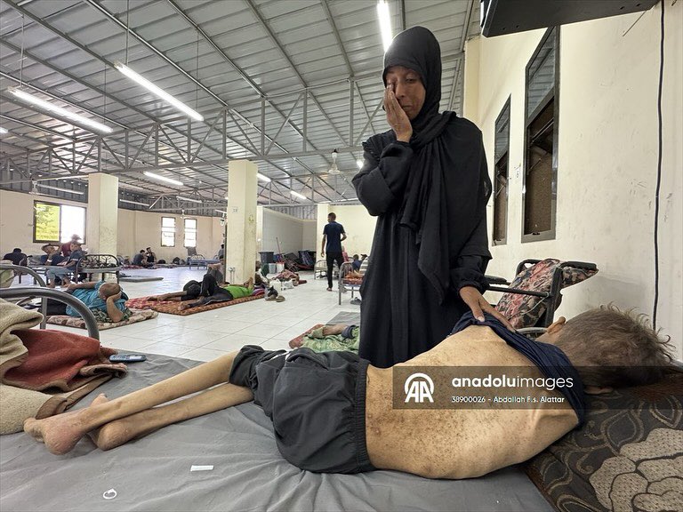 Abdallahallattr's tweet photo. from concussion and short in height, his brother Youssef faces repeated respiratory crises as a result of his asthma, in a scene that embodies the depth of the health tragedy that
the people of Gaza are experiencing under siege.
#freepalestine #stopbombinggaza #stopthestarvation https://t.co/6rK0kKL32N