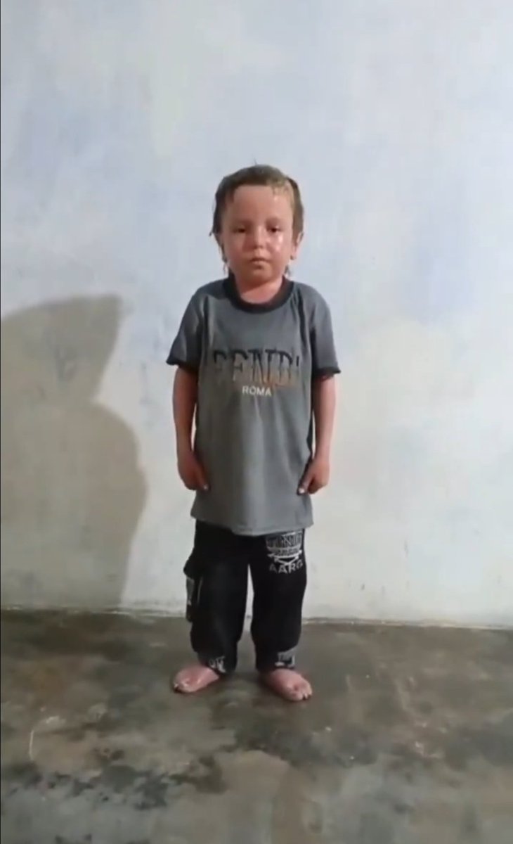 Abdul Rahman faces the daily struggle of psoriasis and arthritis.

With just $100 left to collect, we can cover this month’s treatment that brings him real relief.

Please send a private message if you’d like to contribute and help ease his pain.