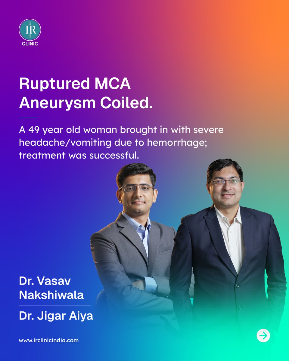 irclinic2018's tweet image. A 49-year-old woman had a severe brain bleed from a ruptured MCA aneurysm.

IR Clinic's Dr. Vasav &amp;amp; Dr. Jigar performed immediate aneurysm coiling, securing the rupture &amp;amp; preventing life-threatening hemorrhage. Every second counted. Success!

#BrainAneurysm #NeuroIR #Coiling