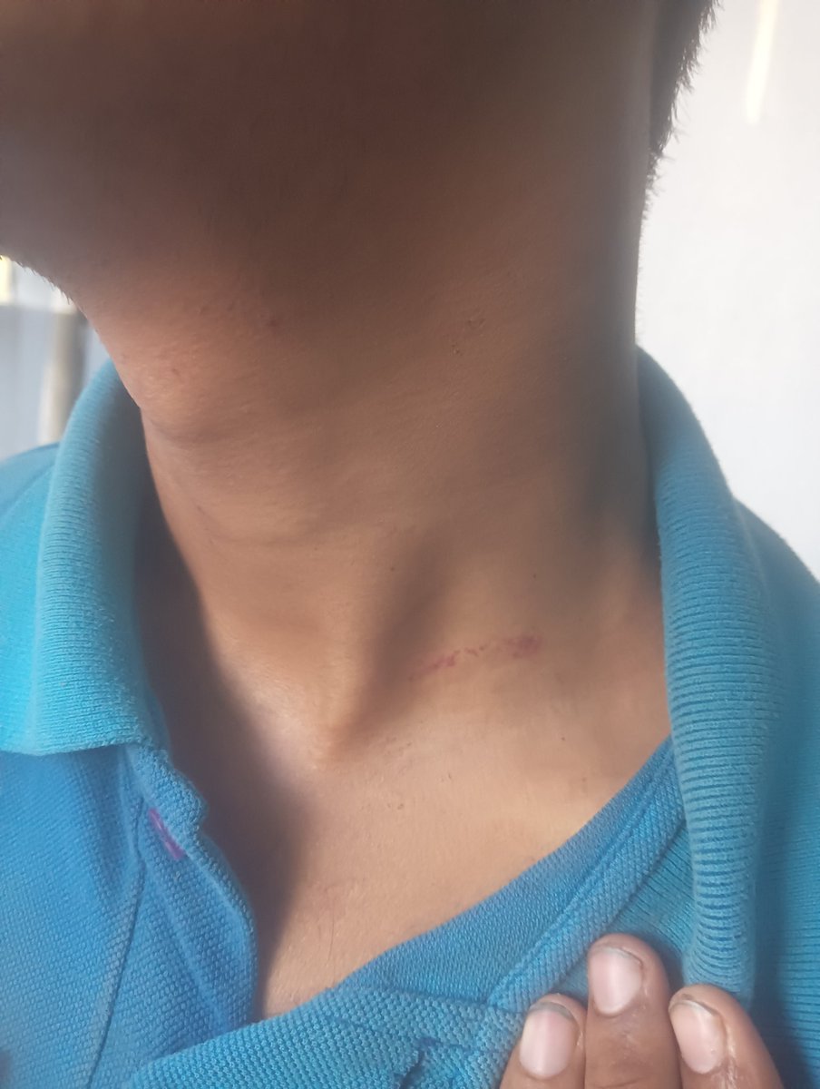 LalitNOfficial's tweet photo. I sincerely request the management to address this issue and ensure a safe, respectful workplace for everyone. #WorkplaceRespect #EmployeeWellbeing #Chilliesindia #Employerrespect https://t.co/rbXND3u18p