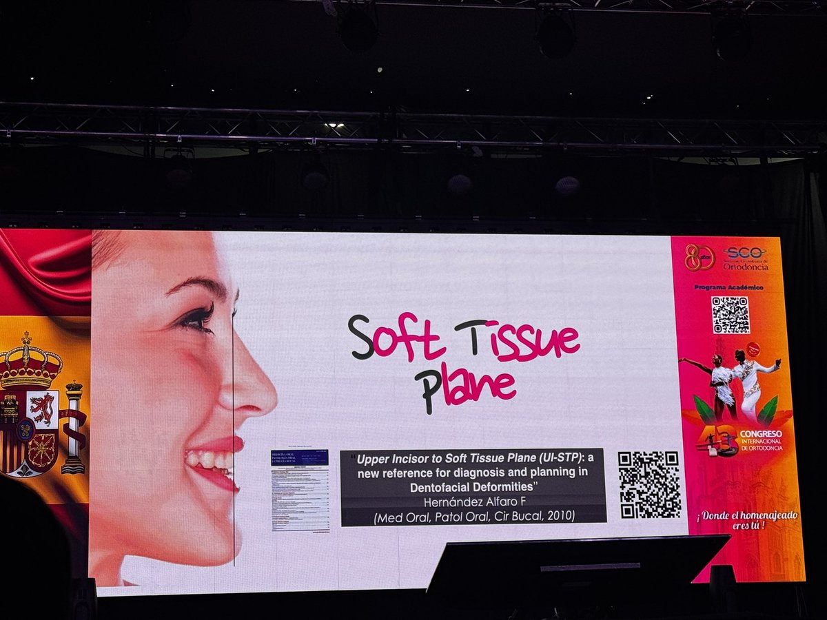 Adrisabogal09's tweet image. CONGRESO INTERNACIONAL!! Modulo CIRUGÍA ORTHOFACIAL SURGERY 
.

📞 3104289524 - 6023799430 Cali, Colombia
.
.
.
#adrianasabogalmaxilofacial #sonreir #maxilofacial #planeacionvirtual #planeacioncomputarizada #maxilofacial #ortognatica #cirugia #cirugiamaxilofacial #cirugiaprimero