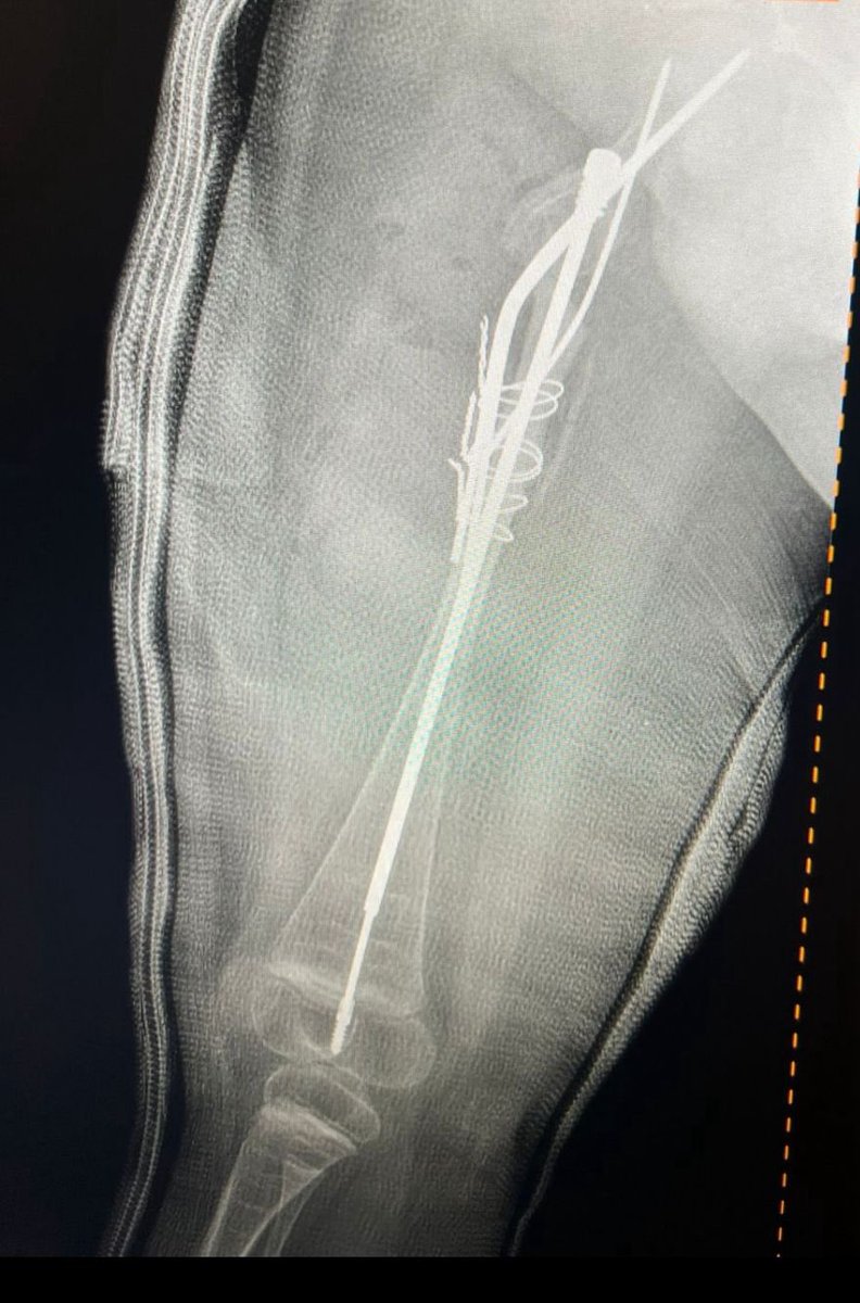 KFHU مستشفى الملك فهد الجامعي tweet media