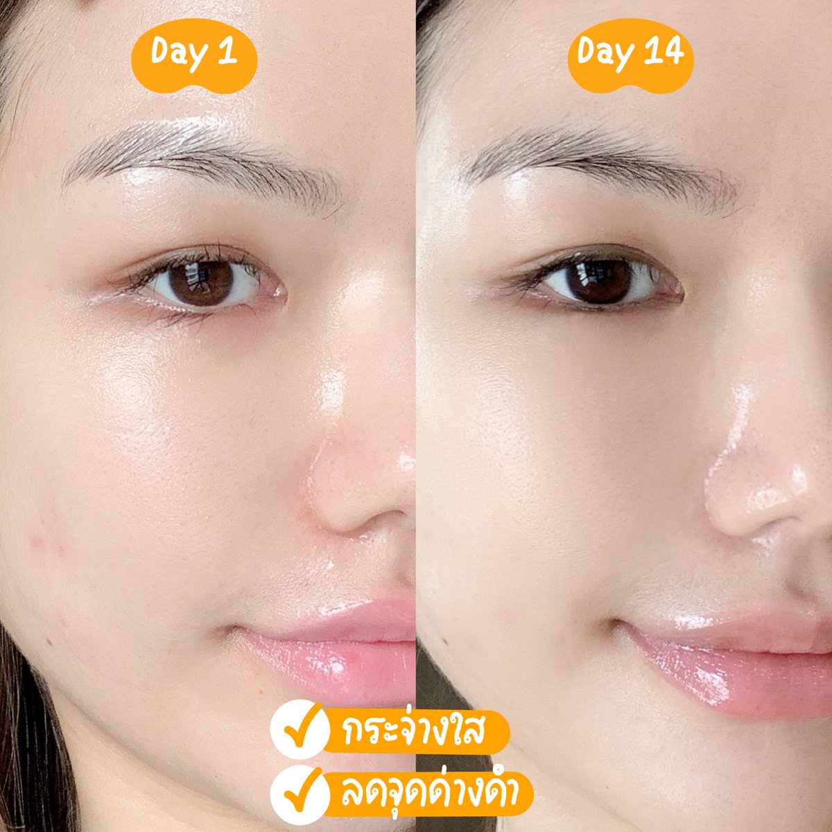 mintitapop's tweet photo. กรี๊ดดดดด New Innovation มากแม่!! สาวๆห้ามงงนะ นี่คือนวัตกรรมที่จะทำให้เราได้ใช้เซรั่มวิตซี ที่ประสิทธิภาพสูงจริง!! น้องคือ SKINTIFIC 10% Vitamin C Brightening Serum หรือ เซรั่มวิตซีเฟรช คือ SKINTIFIC นำ 1 ก้าวอีกแล้ว เค้าให้เราผสมเซรั่ม วิตซีสดๆใหม่ๆ ด้วยมือเราาาไปเลย (มีต่อ) https://t.co/iilvk1TfCs