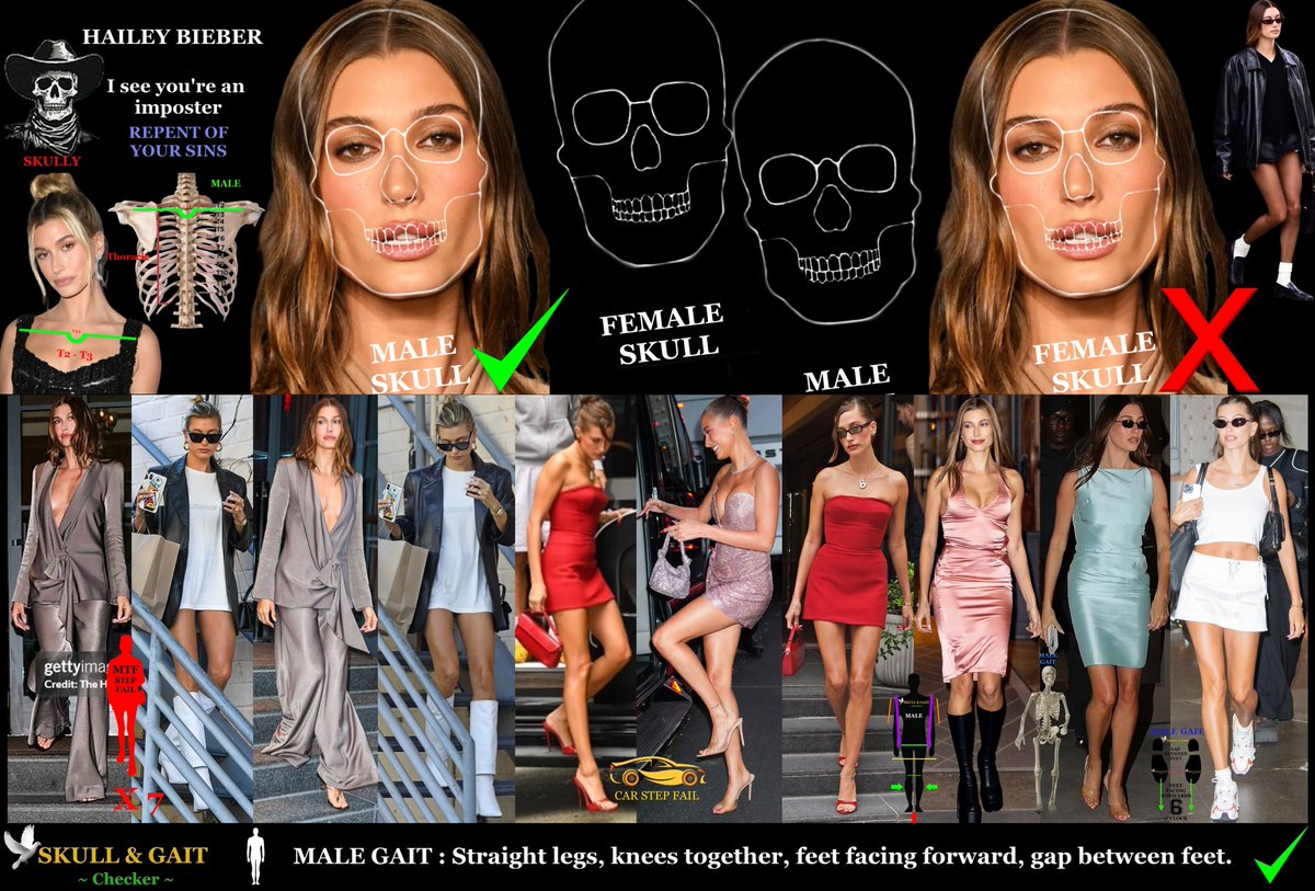 Skull & Gait tweet media