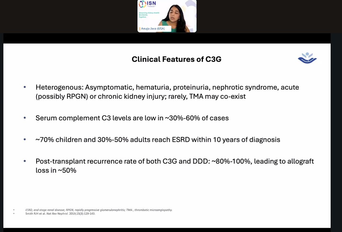 stephanietr612's tweet image. @ISNeducation Webinar: Understanding C3G
From USA @anuja_java
🩺Clinical features of C3G
👁️Extrarenal features: Acquired partial lipodystrophy & Retinal drusen
@ISNkidneycare
#ISNWebinar