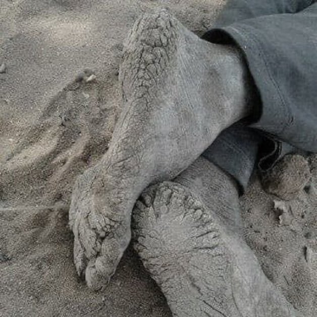 Ayakları bu hale gelmiş ve bu tekinsiz hayat dahi ona çok görülmüş bir insan... görmeden, kayıtsız kalarak kaydırabilecek misin?