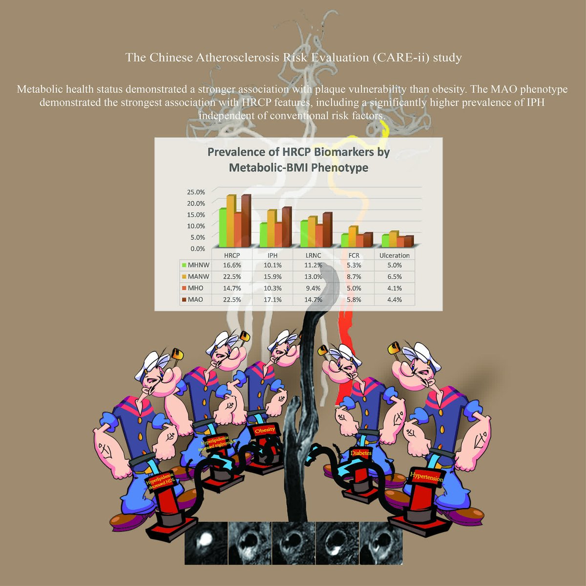 atvbahajournals's tweet photo. Metabolic health outweighs obesity in carotid plaque risk. MAO phenotype shows 70% higher IPH vs MHNW, while MHO mirrors normal-weight stability. #MetabolicSyndrome
https://t.co/gLIvb0L6SE https://t.co/qOP6R98m4k