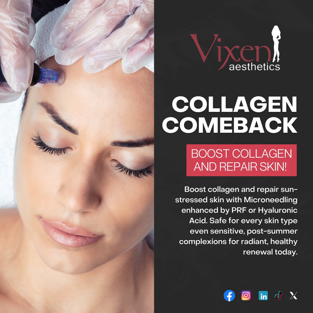 VixenAesthetics's tweet image. Boost your glow with our Collagen Comeback! Microneedling + PRF or HA repairs sun-stressed skin &amp;amp; boosts collagen safe for all skin types. Book now!
🔗 vixenaesthetics.com
#CollagenComeback #Microneedling #SkinRenewal #VixenAesthetics #FallSkincare #GlowUp
