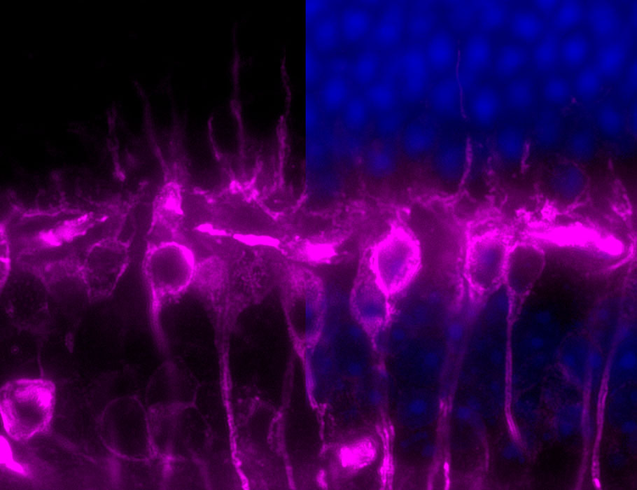 ScienceMagazine's tweet photo. New work in @ScienceTM reveals how a drop in polyunsaturated fatty acids (PUFAs) and the enzyme ELOVL2 correlate with vision decline in aged mice—and shows that intravitreal supplementation of PUFAs can reverse vision loss and rejuvenate the retina. https://t.co/Y5RkBbXoTT https://t.co/ONZR9FYn1T