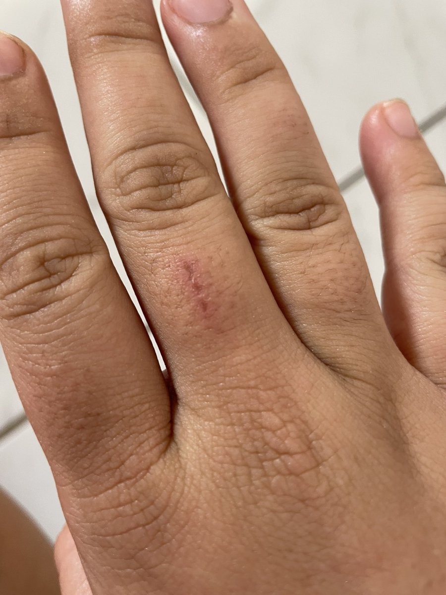 Em alguns bons anos de militância, a primeira vez que vejo uma barbárie tomar conta de uma eleição do movimento estudantil potiguar foi ontem no congresso da UEE/RN. Fui, assim como outros militantes da oposição, covardemente agredida por dirigentes da UJS,+