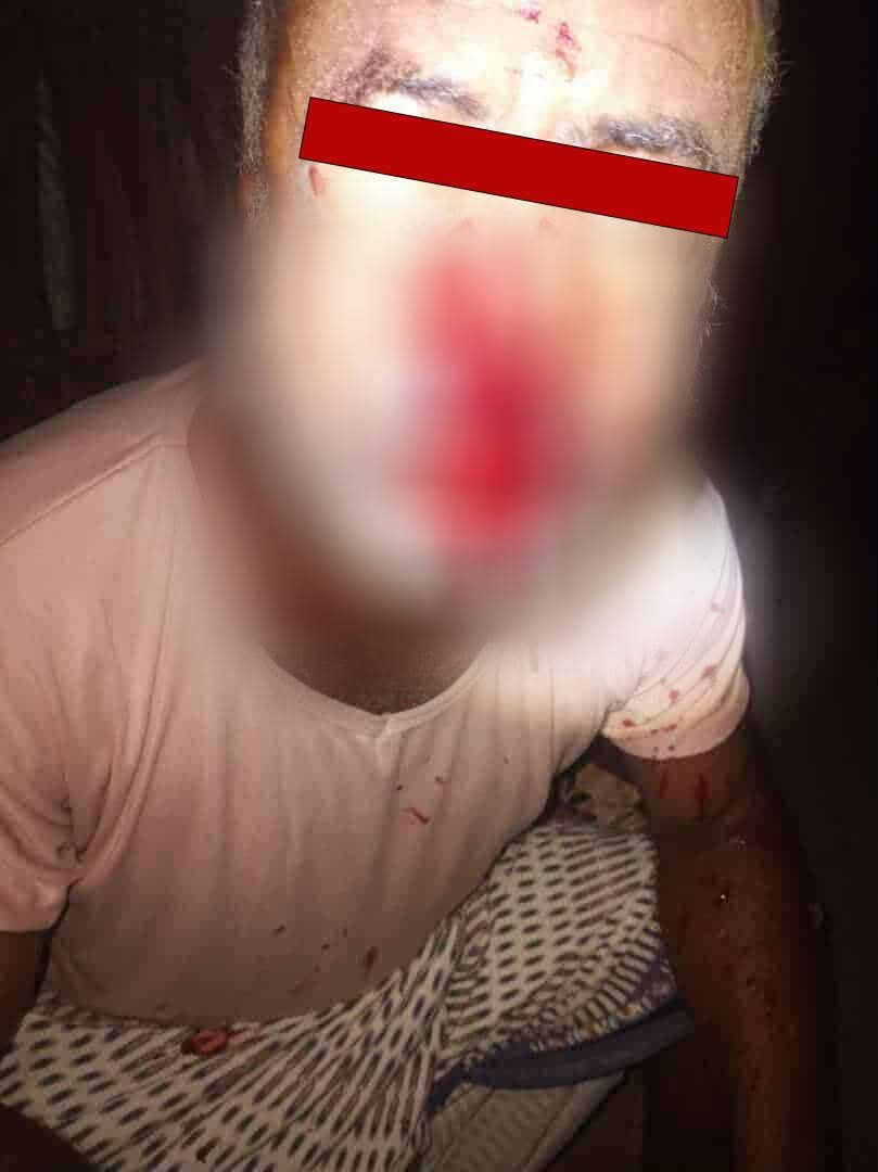 صورة العم محمد خالة بنت قرية الهارونية #فداء
بعد أن تعرض للاعتداء والضرب من قبل مجموعة ملثمة يوم امس وحاليا يرقد في العناية المركزة ولم يتم القبض على المعتدين إلى الان 

#العدالة_لفداء