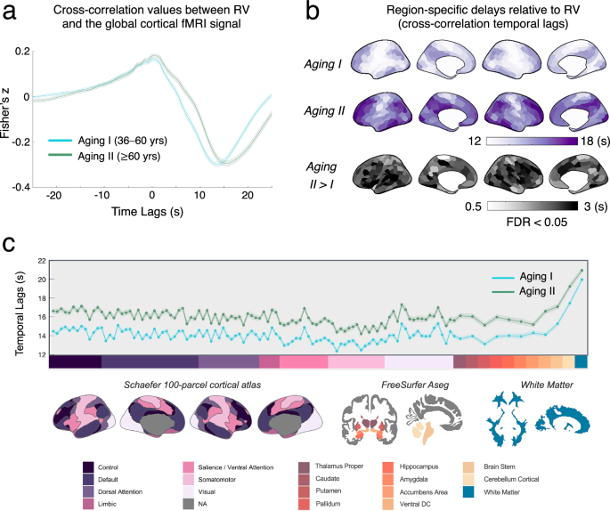 CommsBio's tweet photo. Functional MRI signatures of autonomic physiology in aging: Communications Biology, Published online: 27 August 2025; doi:10.1038/s42003-025-08703-7Functional magnetic resonance imaging signals linked to heart rate and respiration reveal age-related… https://t.co/7wZEJ31IoC https://t.co/HLqpm8jPIq